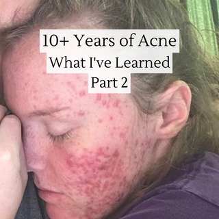 I've had Acne for 16 Years - This is What I've Learned - Part 2